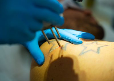 Dottoressa Wang Medicina Estetica Laserterapia Padova