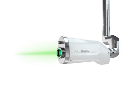 Eliminare Tatuaggio con Laser a Padova