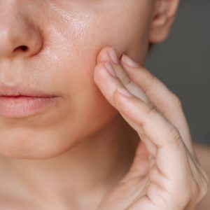 Trattamenti Medicina Estetica Pori Dilatati Pelle Spenta Padova