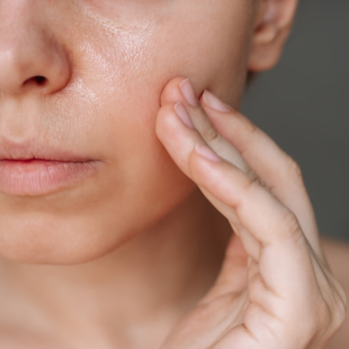 Trattamenti Medicina Estetica Pori Dilatati Pelle Spenta Padova Trattamenti Medicina Estetica Pori Dilatati Pelle Spenta Padova