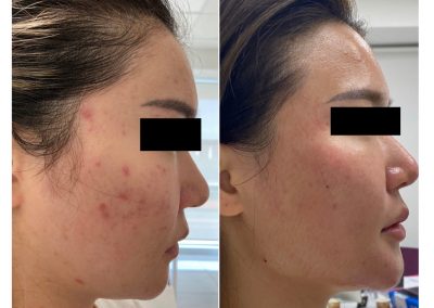 Trattamento Full Face in Medicina Estetica