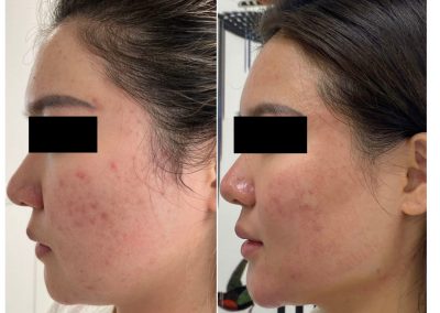 Trattamento Full Face in Medicina Estetica