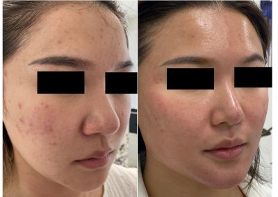 Trattamento Full Face in Medicina Estetica