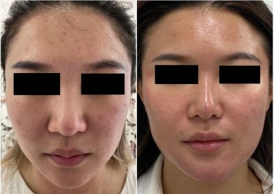 Trattamento Full Face in Medicina Estetica