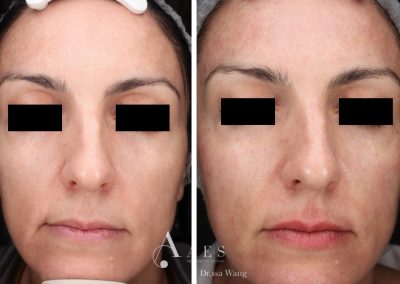 Trattamento Prima Dopo TINT LIP