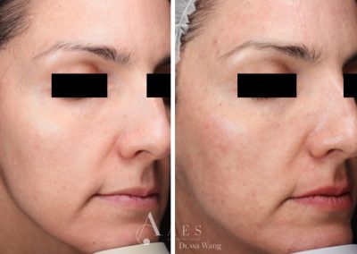Trattamento Prima Dopo TINT LIP