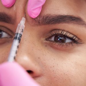 Trattamento Rughe Glabellari Padova